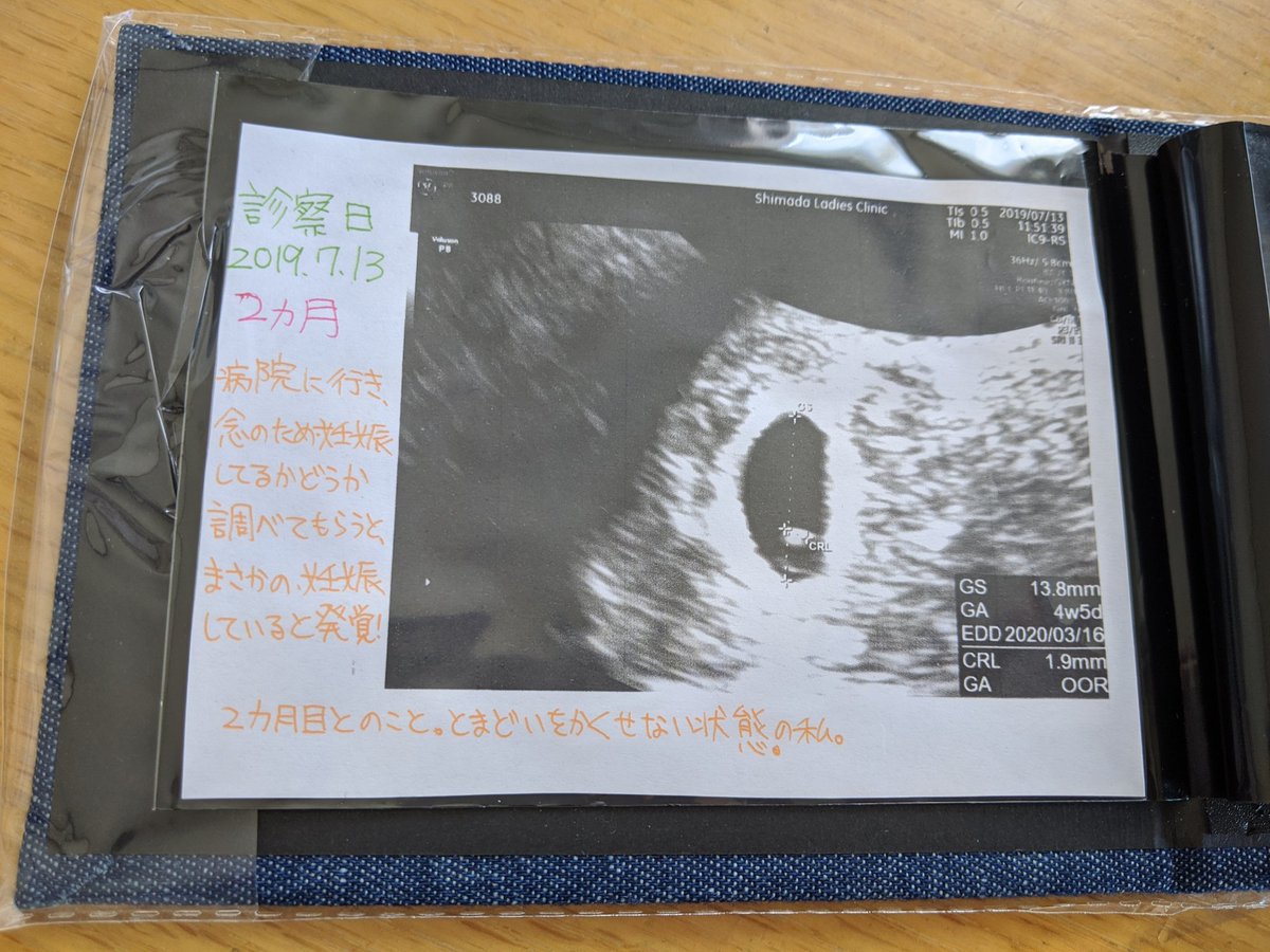 エコーアルバム エコーアルバム