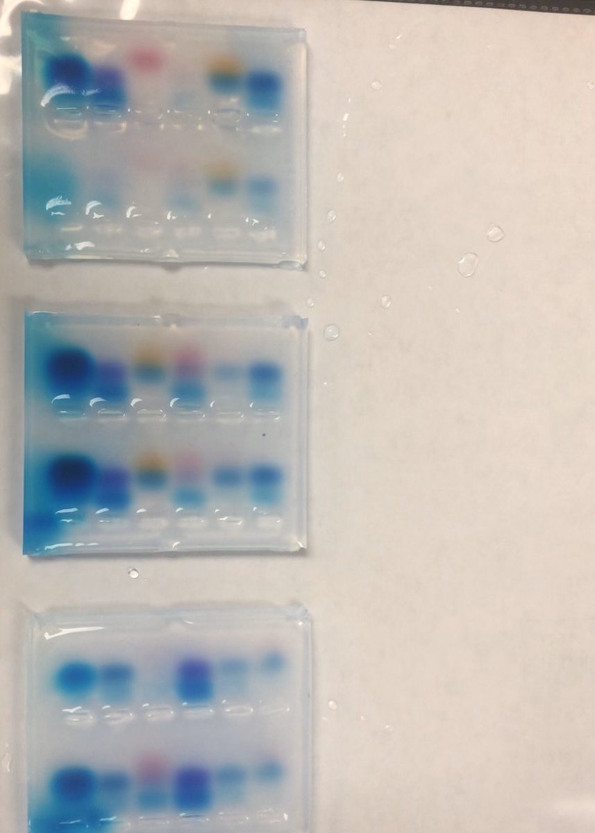 Loading &amp; running gels #APBio #RCHSScience #DNAfingerprinting