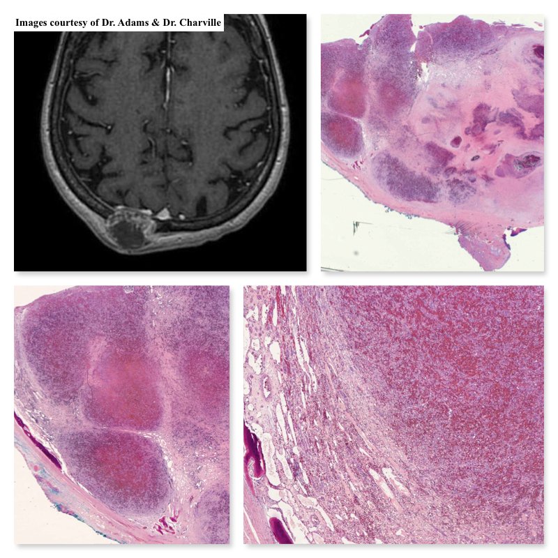South Bay Pathology tweet media