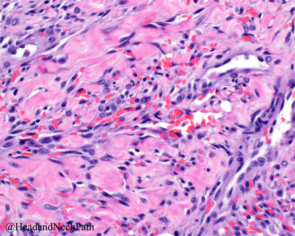 Head Neck Pathol tweet media