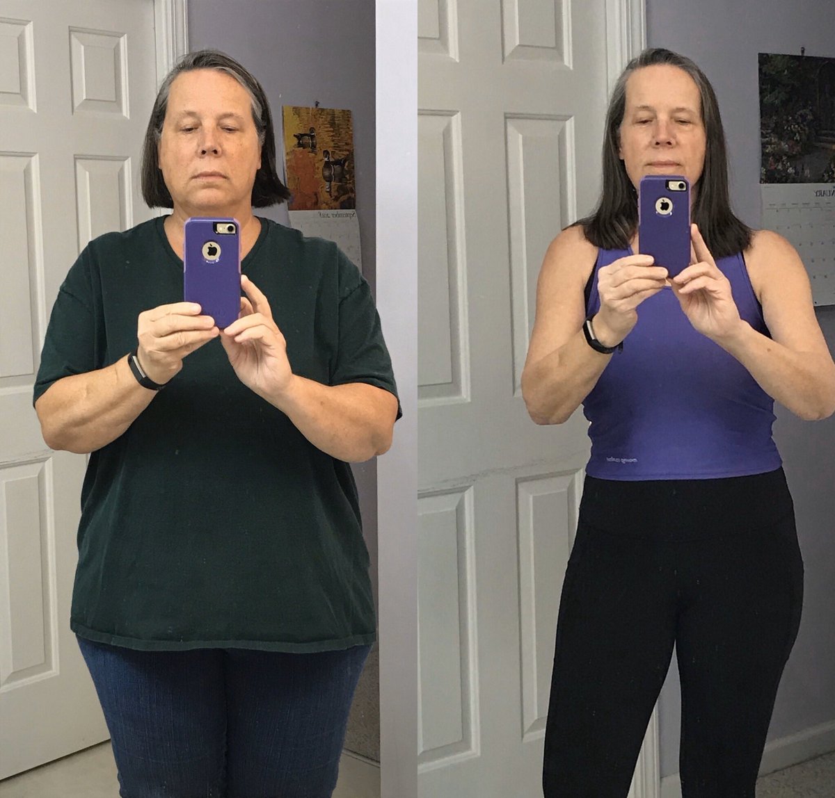 I am 61 years old. I am disabled (Ehlers Danlos Syndrome.) I have been eating keto/low carb/ IF for the past not quite 17 months. No exercise. 100 pounds lost. If I can do it, anyone can do it. Can’t wait to add some weight lifting and see what happens. #KeyoSuccessStory