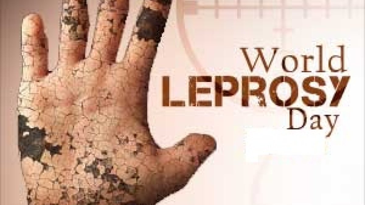 всемирный день помощи больным проказой (лепрой).