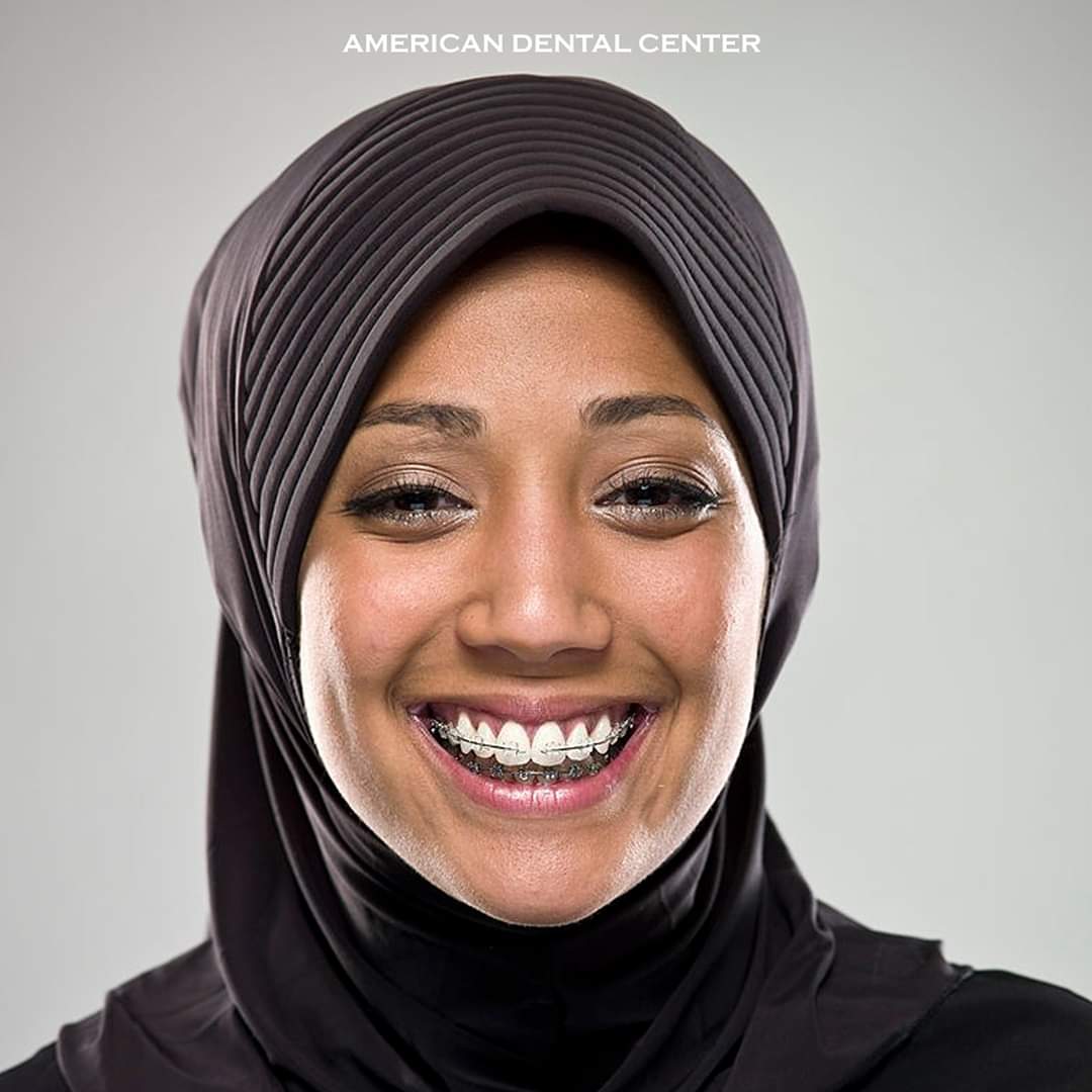 adcmuscat's tweet photo. Our orthodontic care is personally designed for each individual patient; ADC's highly qualified team will ensure the best, most natural looking results. Give us a call to arrange your consultation on 800 SMILE.

#adcoman #عمان #مسقط #طبيب_اسنان_عمان #طبيب_اسنان_مسق #طبيب_اسنان https://t.co/EvGZgfTgMS