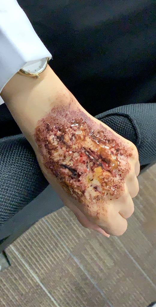 conrw's tweet image. صور من ورشة عمل  the Art of Moulage 
من تقديمالأستاذة يسرى السيد    #مؤتمر_التخصصات2020 #HPC2020