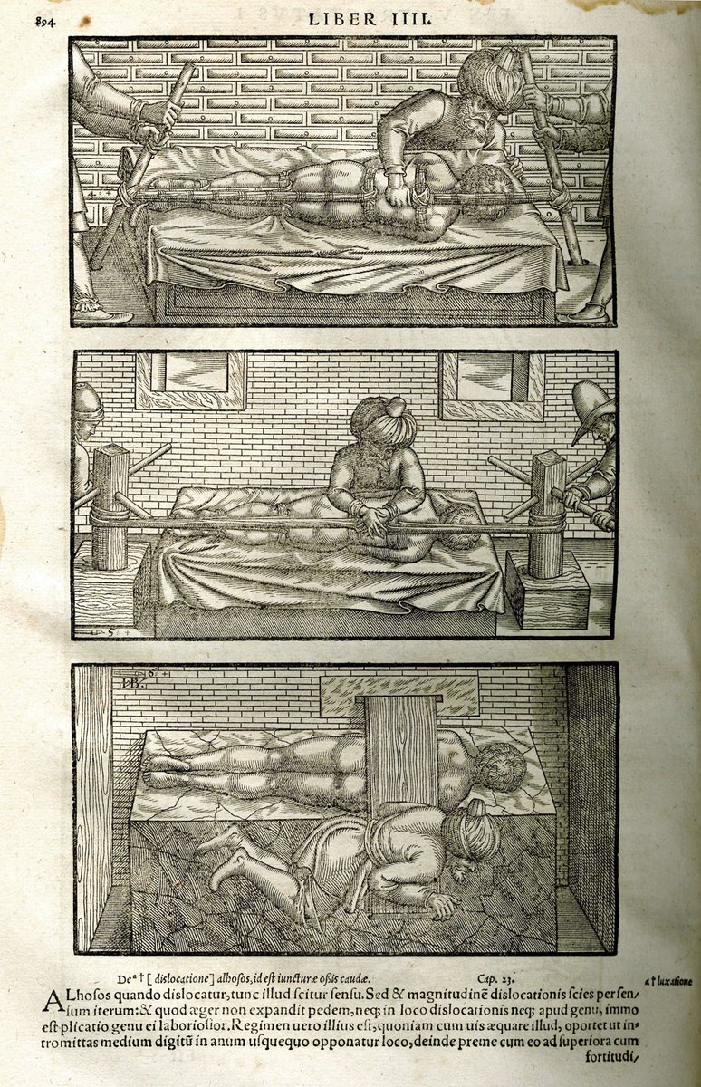 Reduction techniques for spinal deformities. “The Canon of Medicine”. Illustration from the 1556 edition of Persian physician Avicenna’s The Canon of Medicine, a translation by medieval scholar Gerard of Cremona.