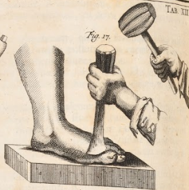 Surgeons, Physicians and Apothecaries: libraries of the medics of York 1700 – 1850 - Exhibition