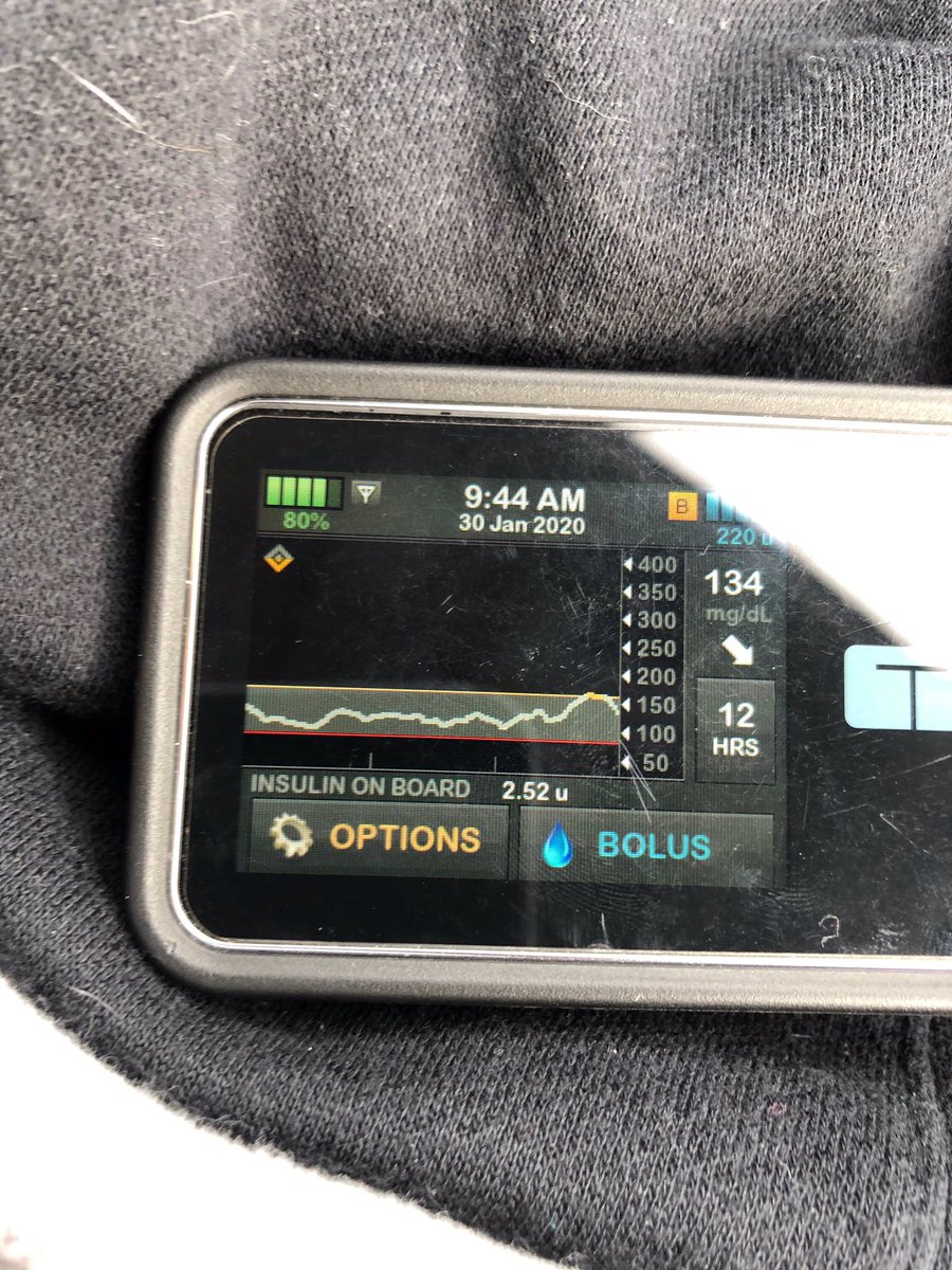 iamcaspi's tweet image. I don’t usually share graphs but Holy Moly Control IQ! It took a few days and a few tweaks to his basal and ISF but it’s doing its thing now! This technology is amazing. 💙 @TandemDiabetes #controliq #T1D