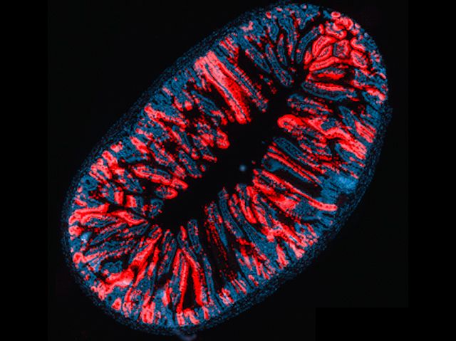 BPoD_s's tweet image. Immune cells target #stemcells in the destruction of intestinal lining cells that occurs before renewal. Research by @AlanHanash @sloan_kettering  in @SciImmunology. Read more on bpod.mrc.ac.uk/archive/2020/1… with @MRC_LMS and @AntDLewis