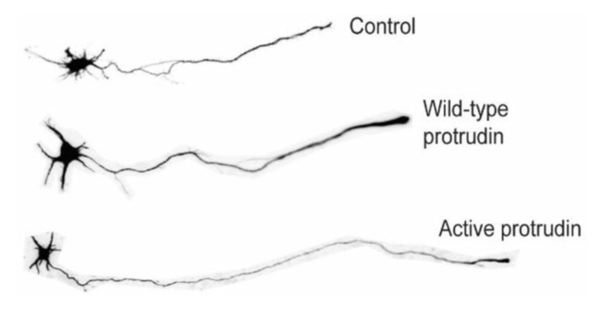 Autonomic Aus on Twitter "Protrudin functions as a scaffold in the