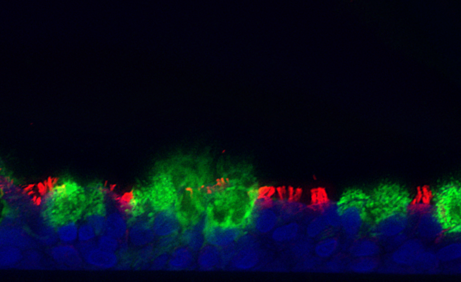dittmannlab's tweet image. Please share!
Want to learn how to generate beautiful human airway epithelial cultures and study their response to respiratory viruses? We are looking for an assistant technician to join our team! Here is the link:
jobs.nyulangone.org/job/10656590/a…