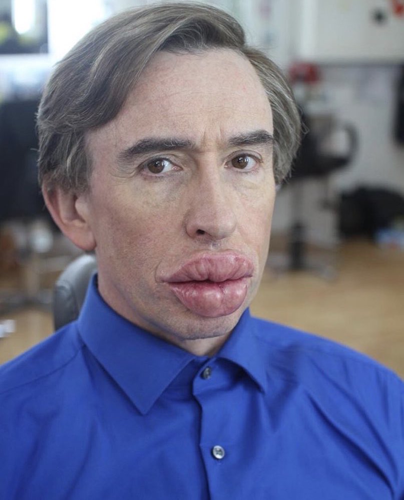 Accidental Partridge (@accidentalp) on Twitter photo 