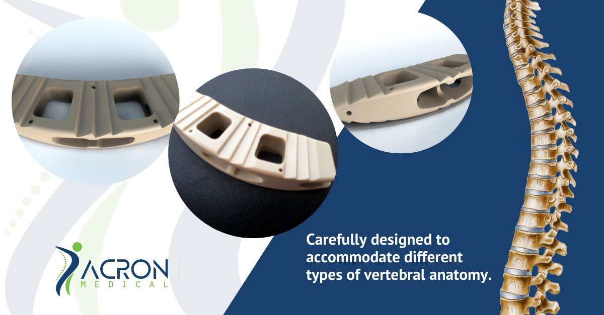 Carefully designed to accommodate different types of vertebral anatomy, &amp; to allow surgeons to address each patient’s sagittal plane requirements, the Acron system includes a full range of implant sizes and heights. Visit Acron-medical.com for more information. #spinefusion