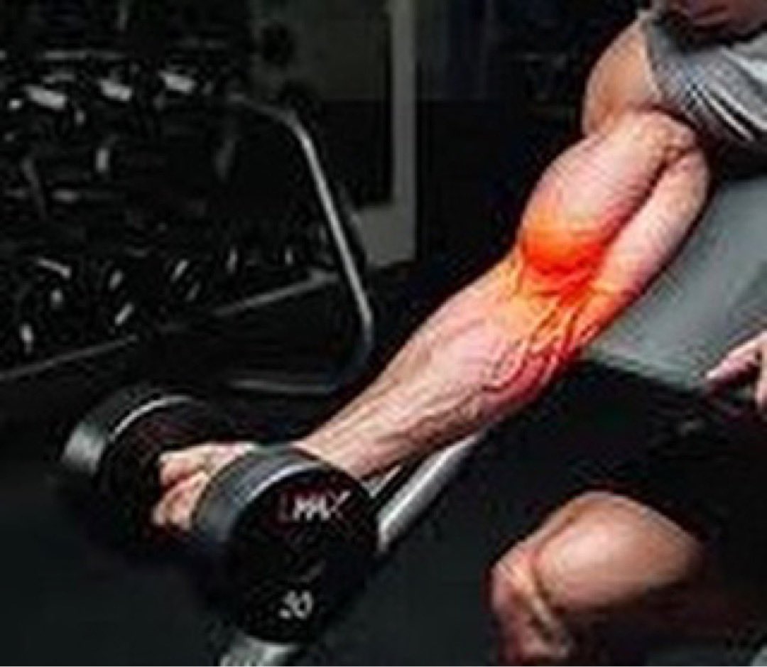 Patient tore his bicep tendon one week ago.  Results are after 3 days of using WINBACK therapy and #hyperbaricchamber. Patient is healing ahead of schedule and the complain was very little pain.

And you what will be your story ??
#physicaltherapy #massagetherapy  #sportsmedicine