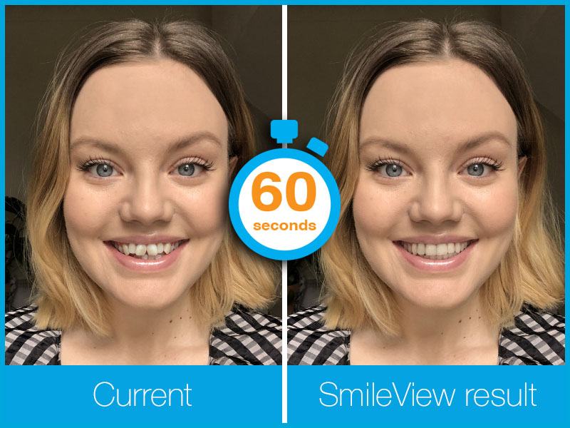 Check out your new smile here, with our unique link. Follow the link below and see what your teeth could look like after Invisalign treatment. Feel free to post your outcomes, we would love to see them...

invisalign.co.uk/SV/299460