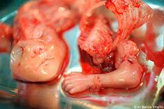 IesuCristus's tweet photo. @Schroederville @NARAL https://t.co/jPFHCzuxKH