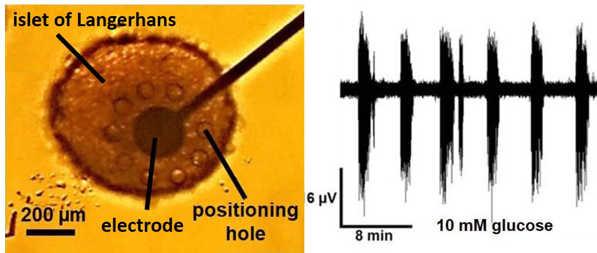 NMI_TT_MD's tweet image. Our #microdevices help to understand and cure diseases! Pancreatic cells show electrical activity dependant on the glucose level. This can be measured in a #microdevice specifically designed for this application helping to understand #diabetes better and develop new therapies.