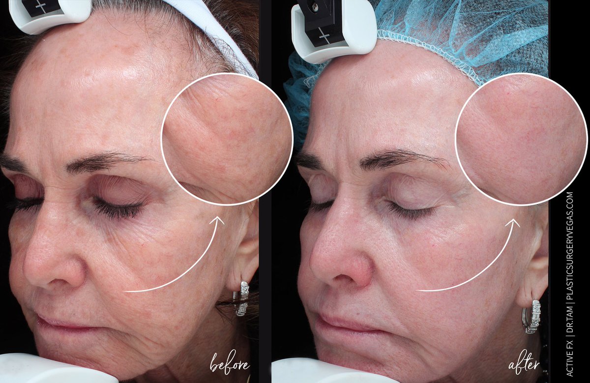 PlasticSurgeryVegas tweet media