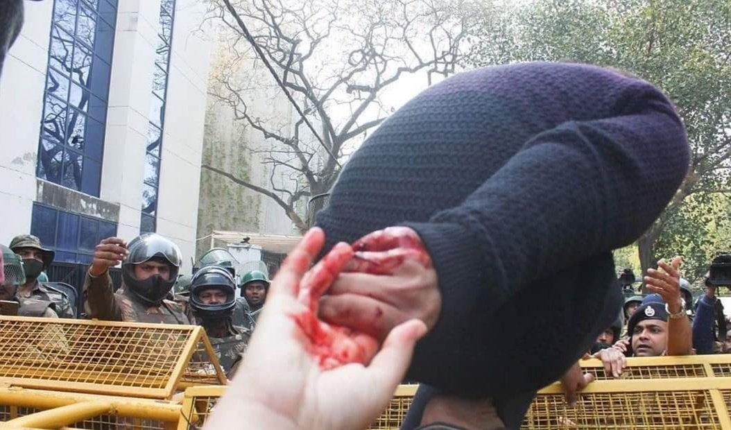 Uzma0104's tweet photo. We will stand, we will fight.
And together, we will rise. 
❤❤

#jamiaviolence
#studentlivesmatter
#longlivestudentunity https://t.co/LOsUzYp2gE