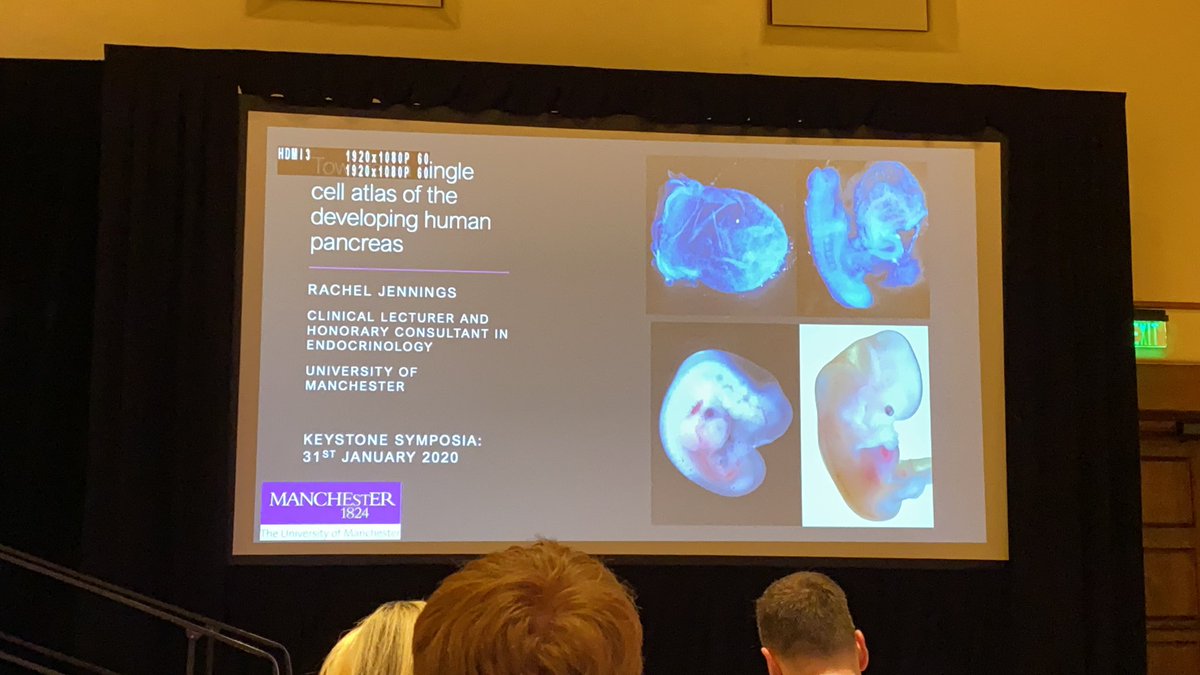 annagloyn's tweet photo. So itโs the last talk of #KSIslet20 & Rachel Jennings from @ManchesterUniv is taking us to the finish line with a short talk entitles A single cell atlas of the developing pancreas https://t.co/21ys4R6Pbi