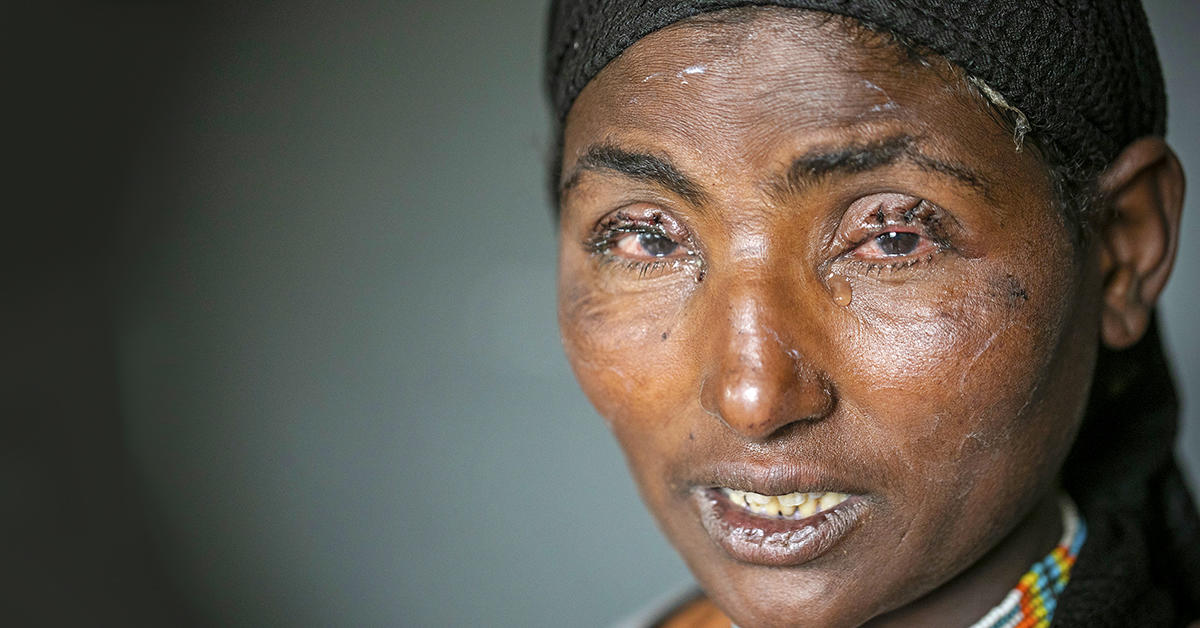 Fatuma from Ethiopia lived with trachoma for years until we helped her get the surgery she needed.