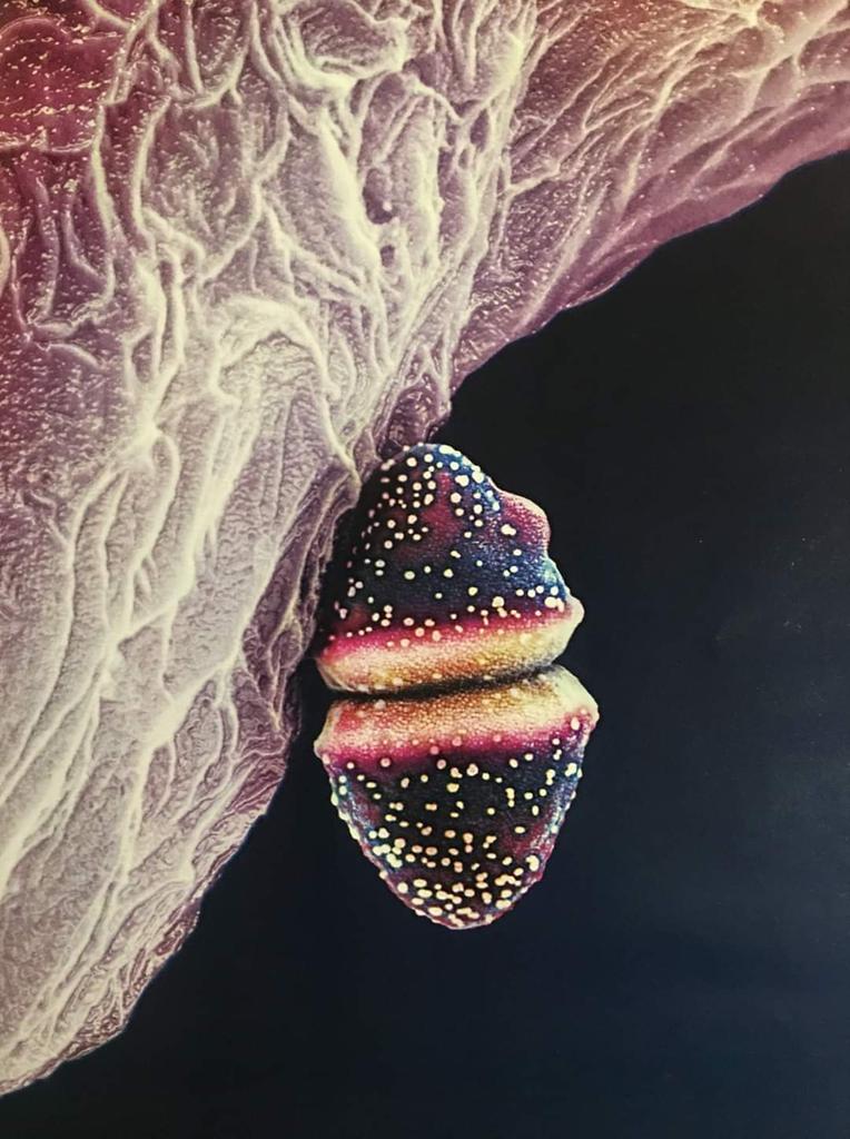 ImgenesMicrosc1's tweet photo. Imagen tomada de National Geographic en español (1.2020), el autor Martin Oeggerli quién es un biólogo molecular suizo que se especializa en captar la belleza del mundo microscópico, la imagen corresponde a Streptococcus pneumoniae... https://t.co/pmAI4ym5Dz