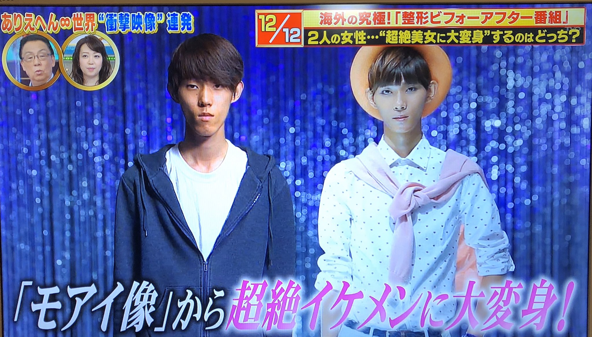 All Beauty Japan 公式 美容整形無料相談所 ありえへん世界 で紹介されていた人生を変えるレベルの ビフォーアフターをご紹介 美容医療をもっと身近に感じて欲しい弊社としてはこういう番組はありがたいです コンプレックスを解消して自分に自信を All Beauty Japan 公式 美容整形無料相談所 ありえへん世界 で紹介されていた人生を変えるレベルの ビフォーアフターをご紹介 美容医療をもっと身近に感じて欲しい弊社としてはこういう番組はありがたいです コンプレックスを解消して自分に自信を