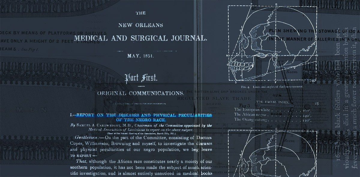 Photo of page from 1850s medical journal talking about "The physical peculiarities of the Negro race"