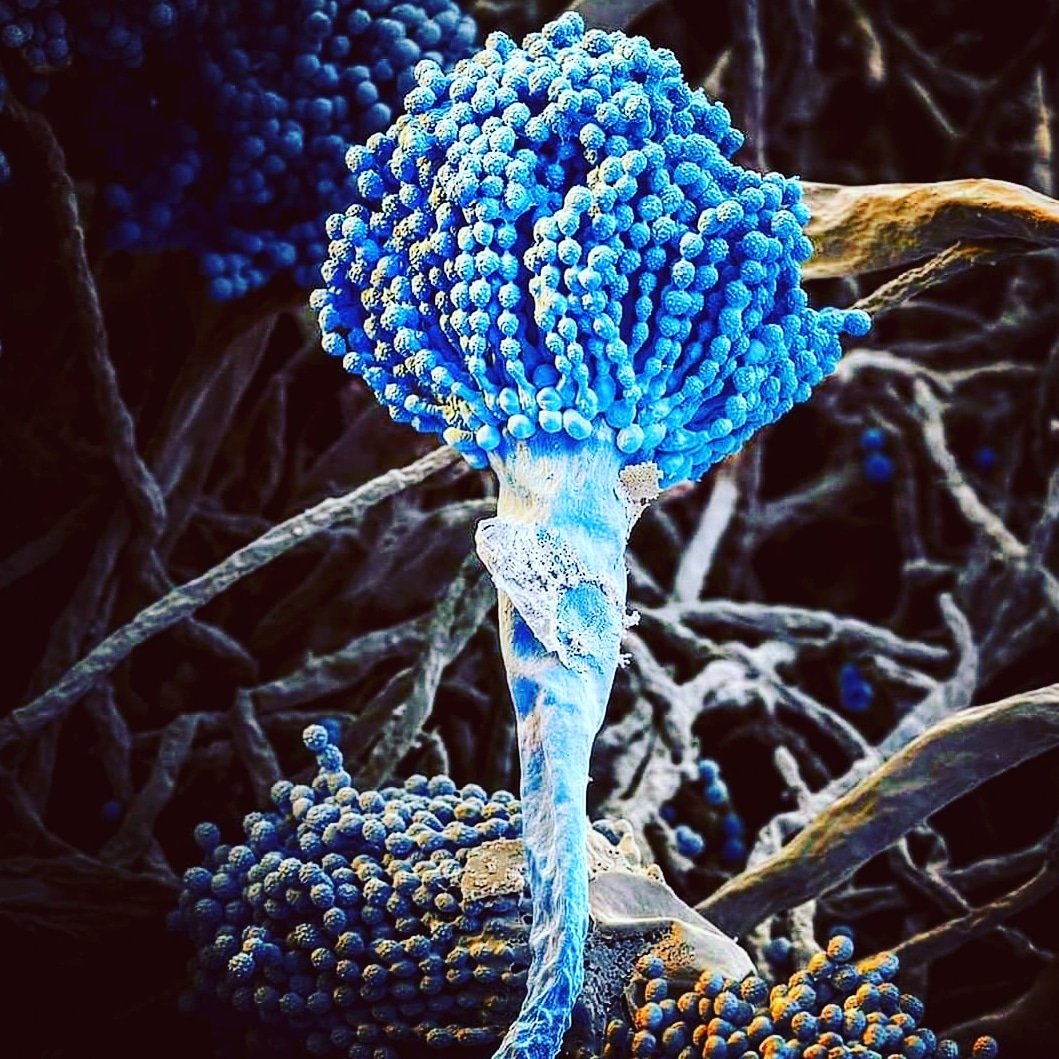 ImgenesMicrosc1's tweet photo. Aspergillus niger visto bajo un Microscopio electronico de barrido. https://t.co/xu2AtCHcjD