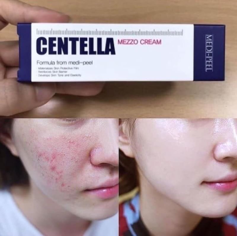 skin_byss's tweet photo. 🔮☁️ เซตเซรั่มและครีมปราบหลุมสิว ผิวกระชับ🪐

🍁#MEDIPEEL centella 30ml
🍁#greymelin bifida 50 ml

〰️ ลดรอยสิวและหลุมสิว พร้อมช่วยให้ผิวกระชับ เรียบเนียน รูขุมขนละเอียดขึ้น ดีจนต้องสอยน้องๆมาคู่กัน!💗😂

📮700฿ (ems+20)

#ssจับคู่ #howtoperfact #ของดีบอกต่อ #โปรดีบอกต่อ https://t.co/a2aCdGHCHf