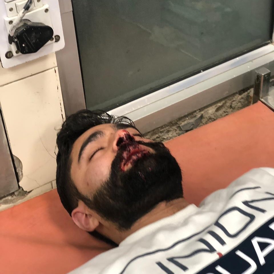 iBirajBiswas's tweet photo. ABVP karyakarta Divyansh Sharma in Panjab University Chandigarh brutally attacked by Left goons of SFS for writing in favour of #CAA2019 in a Facebook comment.
The mask of torchbearers of freedom of expression falls off and a gory, savage face comes to the fore!
#LeftAttacksPU https://t.co/En9Kjxy4oh