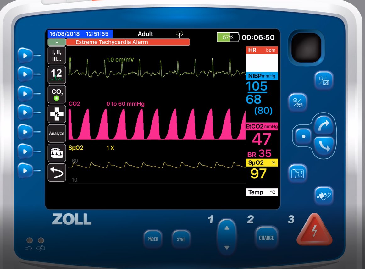 jemsconnect's tweet photo. Using Capnography to Titrate CPAP https://t.co/6Db9rRxguX https://t.co/5TbbfapGus