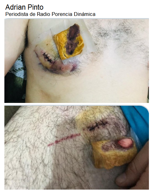 EsmeralPaz's tweet photo. #Bolivia #DictaduraEnBolivia
🇧🇴 6 meses de prisión para Patricia Hermosa (apoderada legar del Sr. Evo Morales)
🇧🇴 4 meses de prisión para Roger Revuelta (RJC) por intento de asesinato al periodista Adrian Pinto
#GeneracionWiphala💯

https://t.co/jSc5ZtWLsP
https://t.co/K6UJKrsoon https://t.co/Bz8HKP3fxm