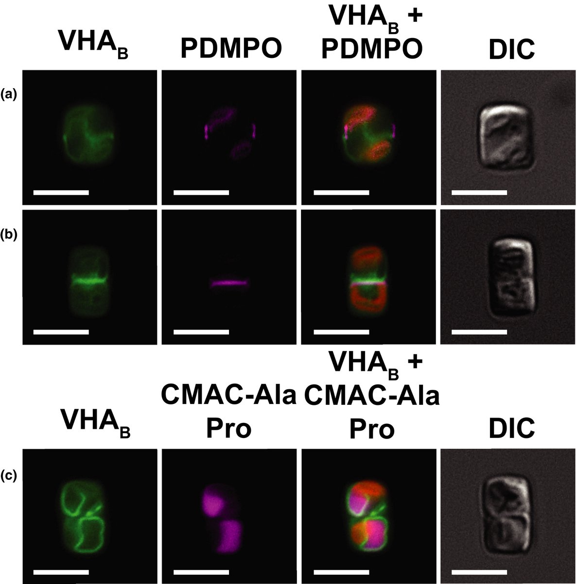 V‐type H+‐ATPase (VHA) localization in multiple subcellular compartments.