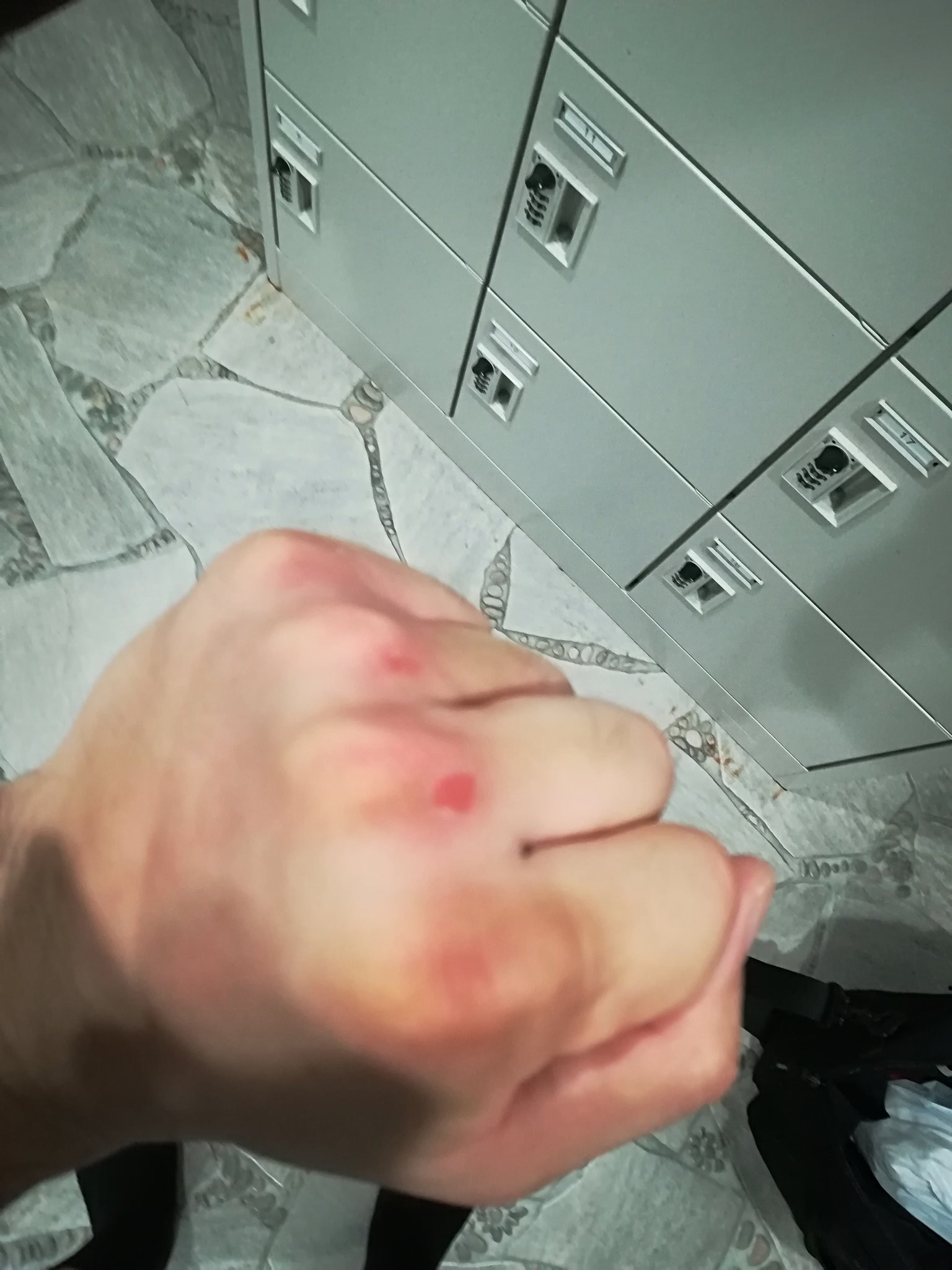 カラテウサギ モンスター井上尚弥もやっているという 裸拳でサンドバッグを殴る練習 空手家の拳からヒントを得たらしい なかなか良い練習だし拳も鍛えられるはず 巻き藁代わりに 毎回皮が剥けます 何故だか左だけ そして見ると薬指の上も ちゃんと