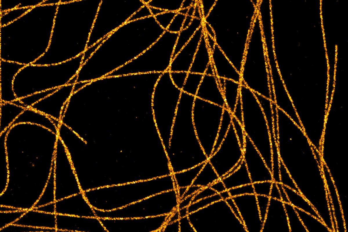 Christophe Leterrier It S Two Anti A Tubulin But It Works As Well As An A And A Ss
