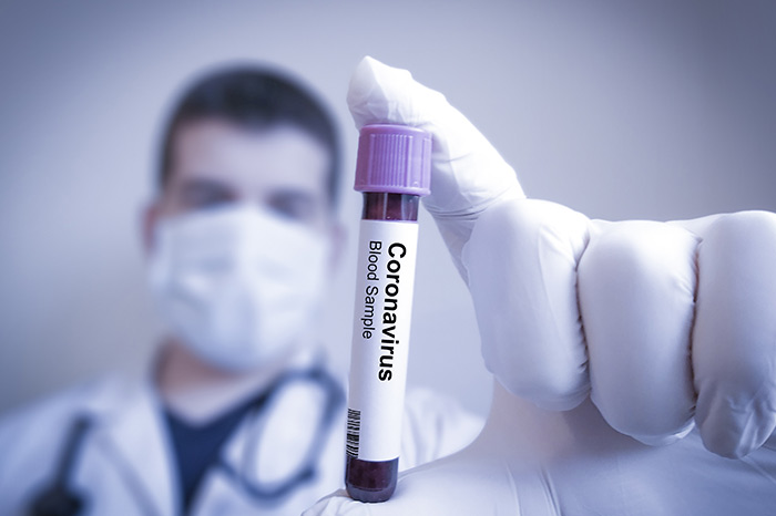 Notre Dame University-Louaize (@ndu_louaize) on Twitter photo In the wake of an outbreak of CORONAVIRUS that began in China, experts will be spreading awareness about the "Coronavirus (2019-Ncov): Myths and Facts".
RSVP: admissionsoffice@ndu.edu.lb
More: bit.ly/38EB2hO In the wake of an outbreak of CORONAVIRUS that began in China, experts will be spreading awareness about the "Coronavirus (2019-Ncov): Myths and Facts".
RSVP: admissionsoffice@ndu.edu.lb
More: bit.ly/38EB2hO