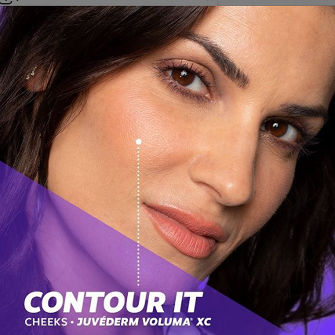 psofny's tweet image. Add volume to contour it in the cheeks with VOLUMA. As you age, the cheeks may flatten and the skin begin to sag  due to age-related volume loss. VOLUMA is designed to add volume beneath the skin's surface, which provides lift and contour to the cheek area.