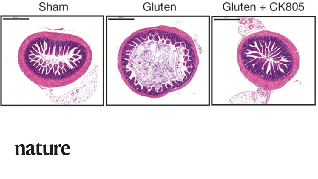 Nature Portfolio on Twitter "A Nature paper presents an accurate mouse