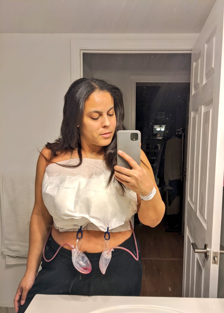 Sharing the process of my breast reduction on my Instagram and my heart is touched by the response from friends and followers as well as the interest that so many women have about this procedure. 
I'm so used to hiding and this experience has encouraged me to open up more! ❤️