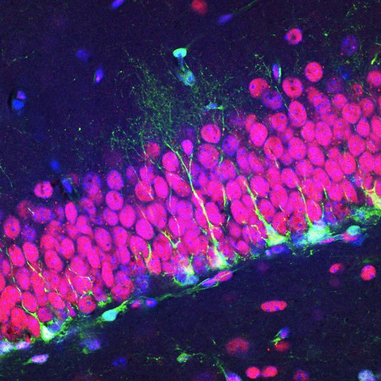 The Sahay lab (sahaylab.com) is hiring a 2020 college graduate for Research Tech (2 year) position.  Successful Candidate will have a strong background in neuroscience or stem cell biology. See Advert for details.  Please RT. 🙏