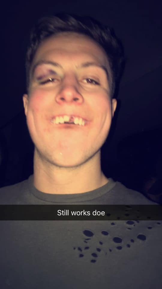 Scrivs Tooth tweet media