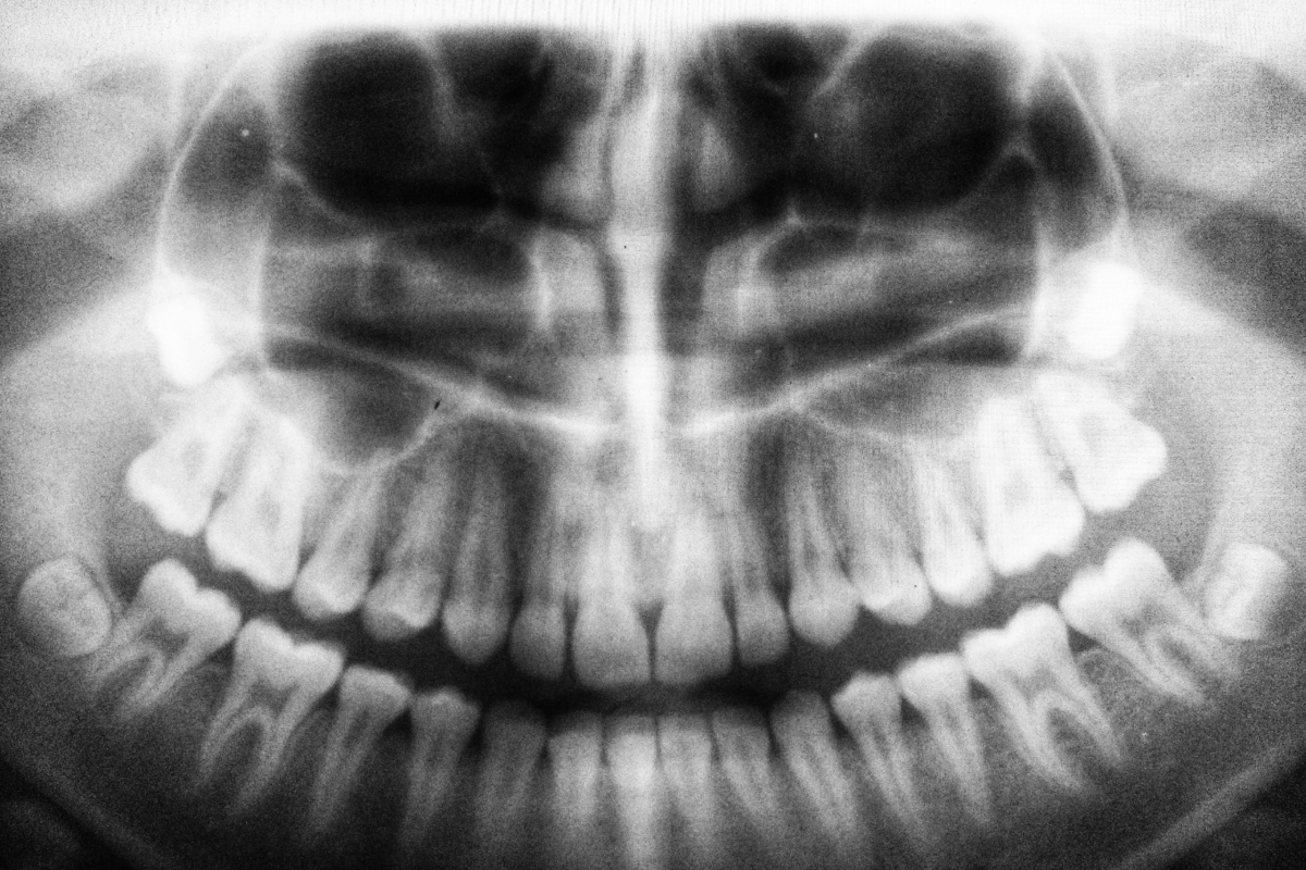X-rays can help identify problems such as cavities, tooth decay, and impacted teeth. Schedule yours today: (972) 867-5989
