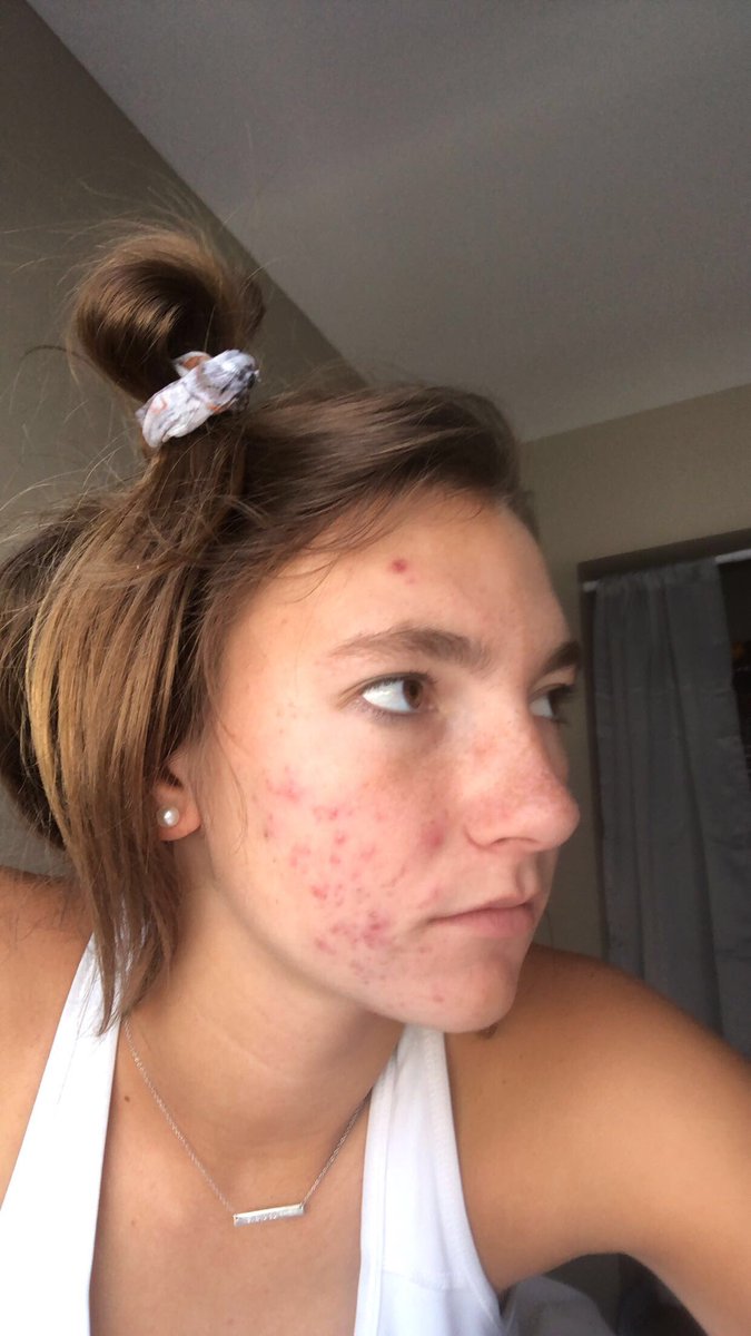CarLee Mechels tweet media