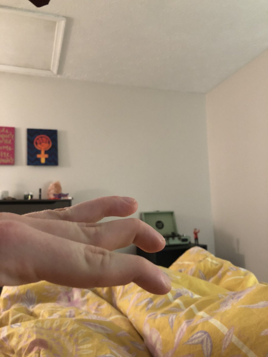 DakDeMarco's tweet photo. So it recently has been brought to my attention that not everyone can bend their fingers at the first knuckle. Can I get a thread of people bending their fingers at the first knuckles. We shall take back our humanity. We will no longer be ridiculed or repressed. We will ri https://t.co/SqrviTzc7p