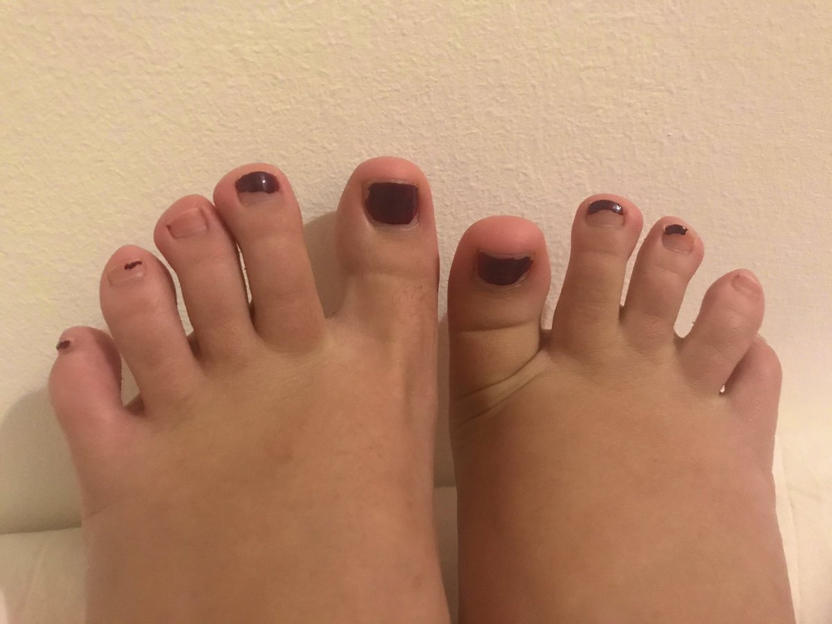 micdropxx2's tweet photo. I miei piedini hanno bisogno di pedicure...
ovviamente pagata da voi, perché sebbene vogliate baciarli, leccarli, toccarli, potere solo pagare per farvi notare da me e per vedere altre foto👣😈

#soles #piedi #feet #smellyfeet #feetpic #feetpicforsale #moneyslave https://t.co/fQANJxIsvp