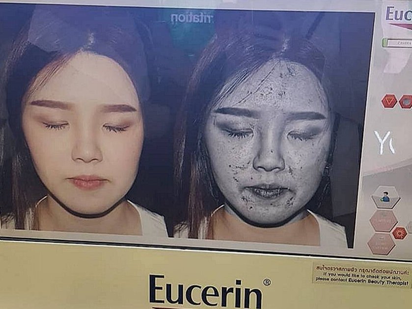 EucerinThailand on Twitter: Eucerinthailand On Twitter: