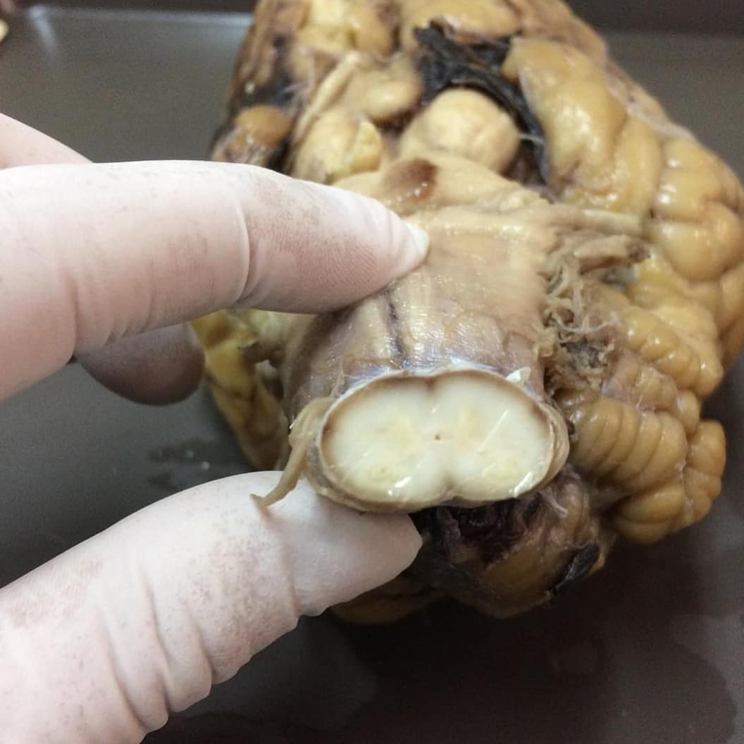 anatomiae_'s tweet image. Apresento-lhes uma belíssima foto de uma medula espinal.