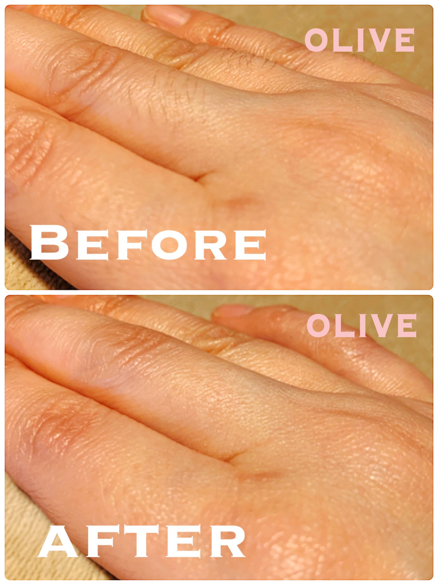 Olive 実はやっかいでは 指毛 ワックス脱毛なら指毛もカンタンにスッキリ 剃ったり毛抜きで抜くよりよっぽど楽で長持ちします 根元から抜くので見た目もキレイ お値段も指毛のみは1000円 腕全体 腕半分なら無料で指毛も含む とお手頃 ぜひ Olive 実はやっかいでは 指毛 ワックス脱毛なら指毛もカンタンにスッキリ 剃ったり毛抜きで抜くよりよっぽど楽で長持ちします 根元から抜くので見た目もキレイ お値段も指毛のみは1000円 腕全体 腕半分なら無料で指毛も含む とお手頃 ぜひ