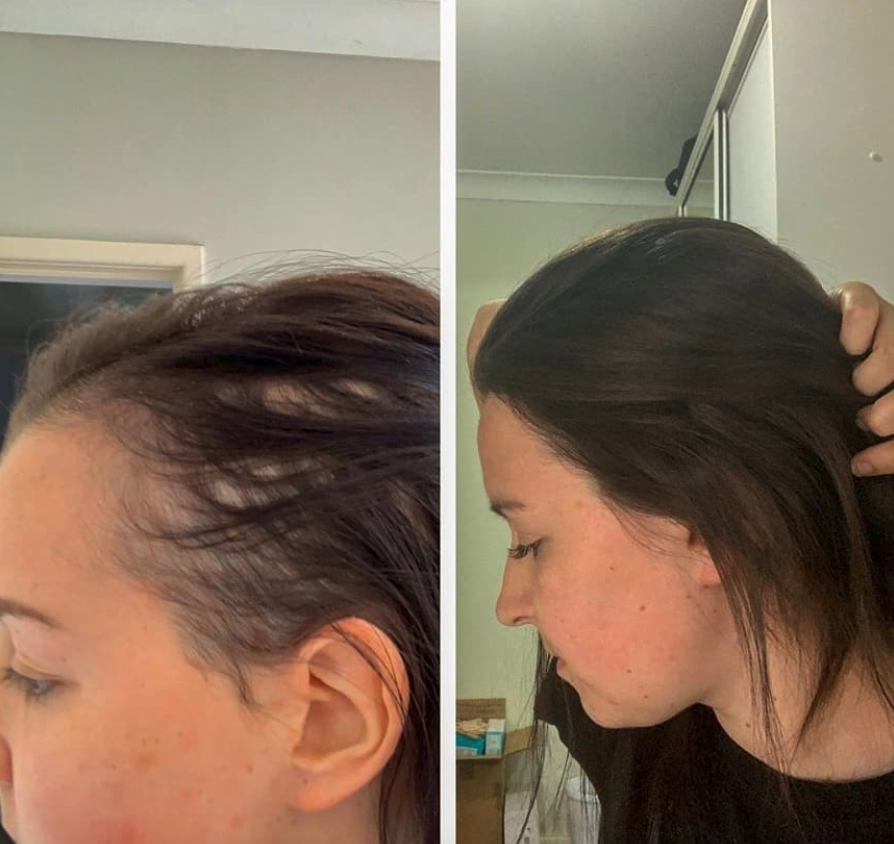 Frank Body Scrub Before And After