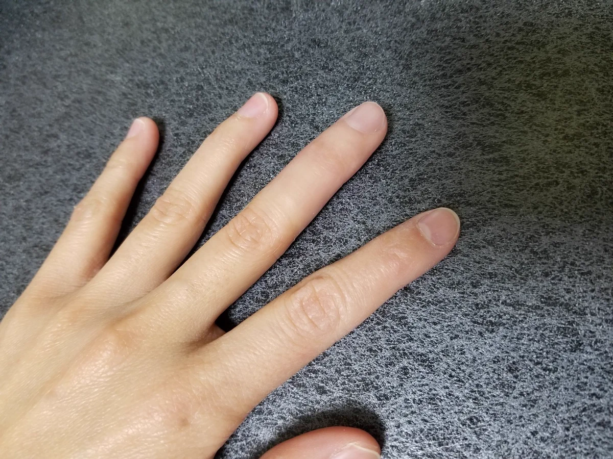 日本の技術の凄さを実感する！！どの指が義肢か全く分からない！！